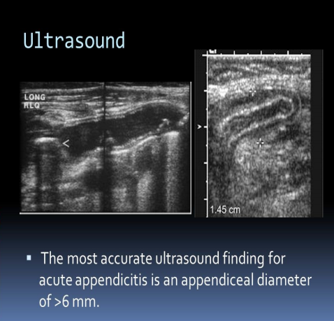 Reproductive Aspects of Acute Appendicitis